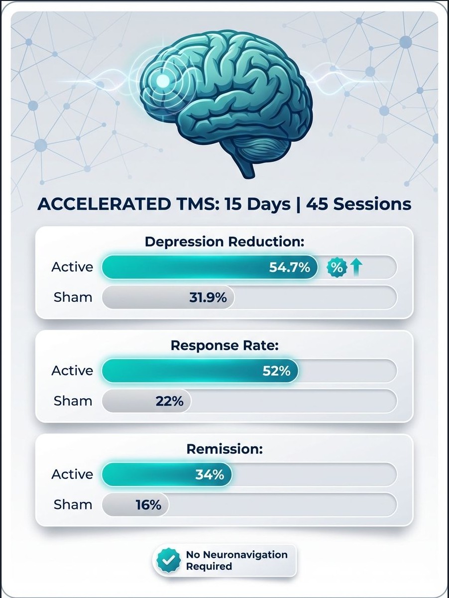 Accelerated Theta-Burst TMS: A New Frontier for Treatment